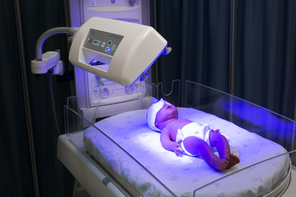 Photothérapie d'un bébé présentant une jaunisse